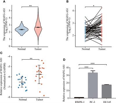 MAFG-AS1 is a prognostic biomarker and facilitates prostate cancer progression